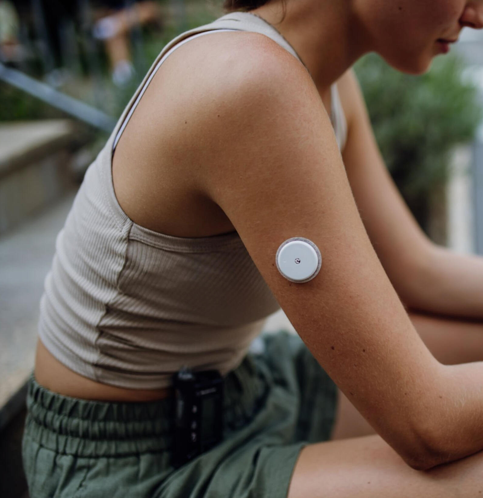 Young adult using CGM sensor and smartphone app for glucose monitoring