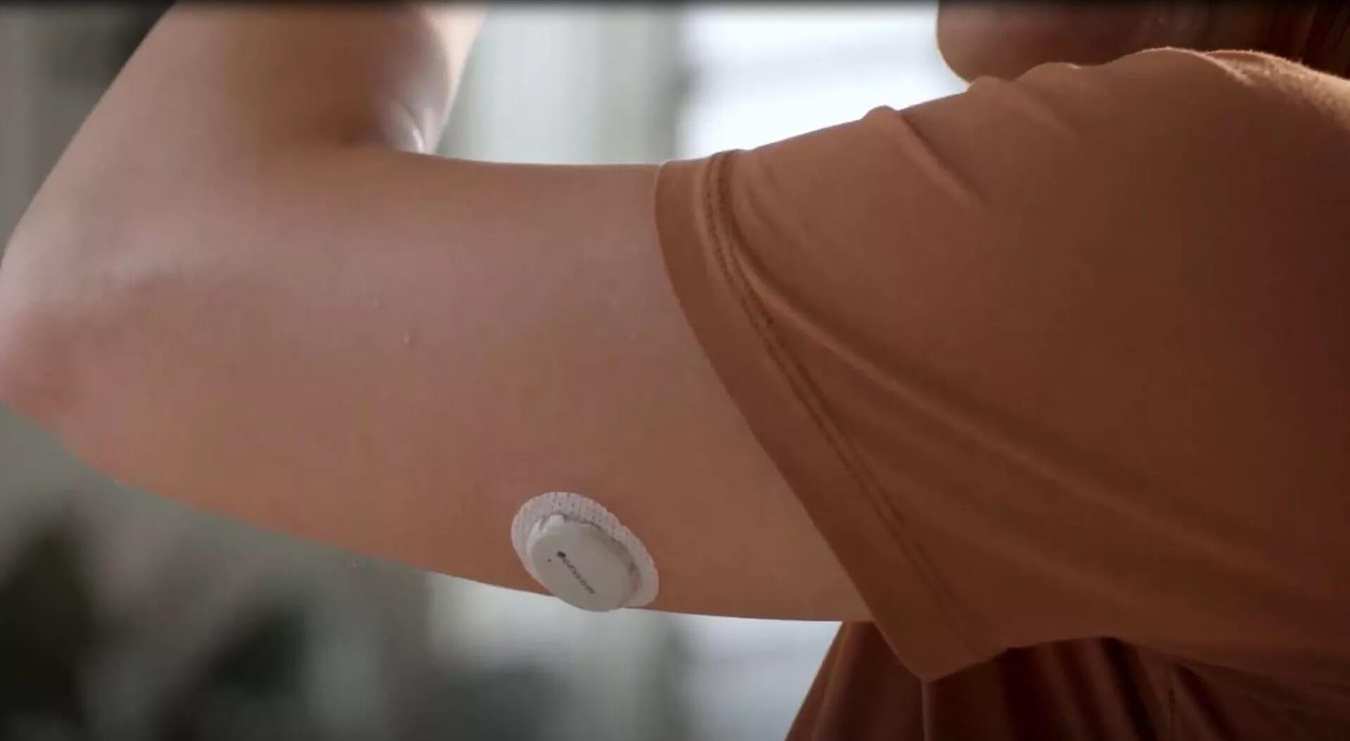 Young adult using CGM sensor and smartphone app for glucose monitoring